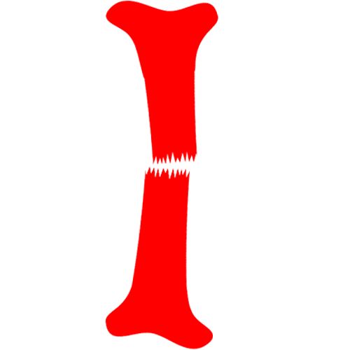 骨折知识图,你知道吗冷知识视频