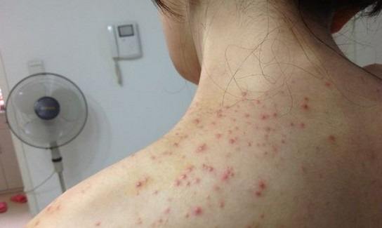 女人小肚子比较大，都是湿气重惹的祸，还不祛湿吗