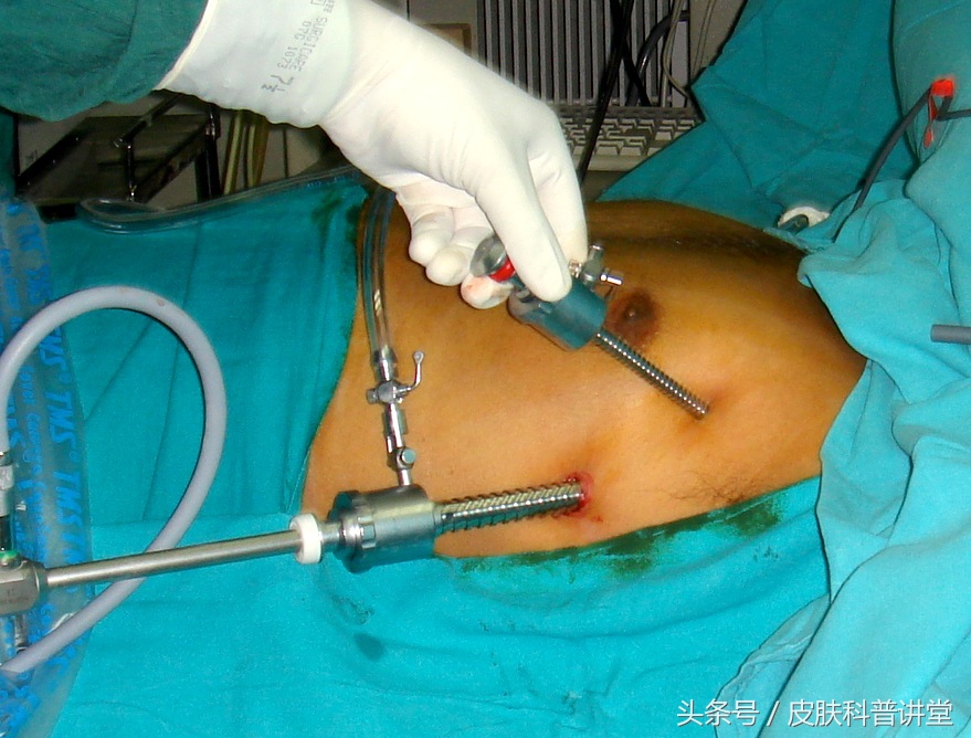 痛苦的时候应该怎么办,痛苦的症状和治疗方法