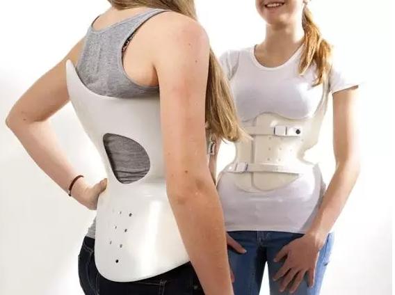 脊柱侧弯治疗最有效最快的办法,脊柱侧弯治疗有几种方法