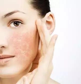 抵抗力下降引起皮肤过敏怎样处理,皮肤过敏后脸部脱皮怎么处理