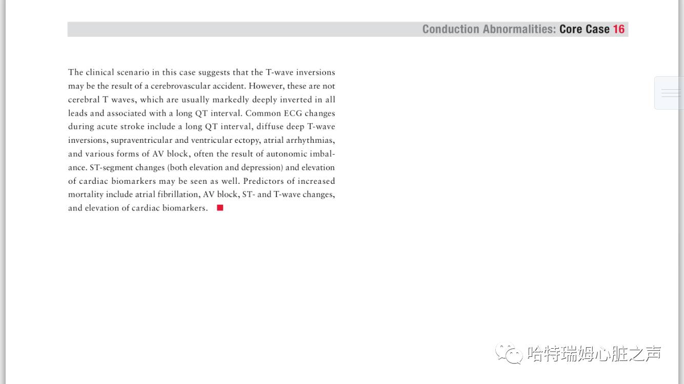 「读心有术」057期：这么多的T波倒置，该怎样诊断？