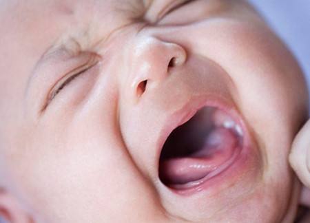 宝宝患上鹅口疮是怎么回事？妈妈正确的做法