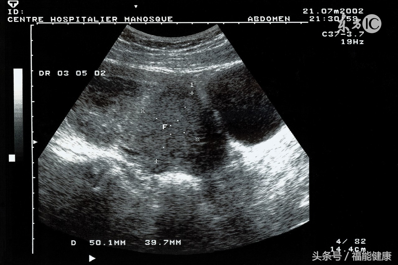 体检解忧,妇科体检必做十大项目