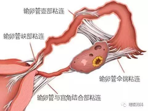 迷路种子,迷路的种子