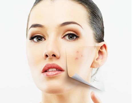 果酸类的护肤品可以祛痘吗,果酸可以治疗激素痘吗