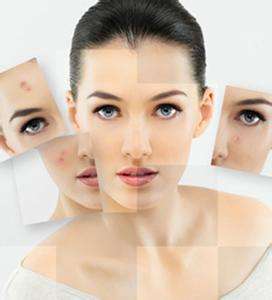 祛痘祛痘印最有效的方法小妙招,教你五种最有效的祛痘印方法