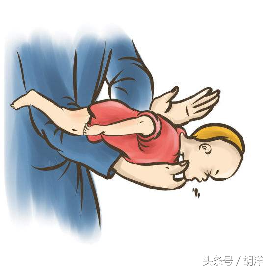 发生气道异物首选急救方法,气道异物抢救措施