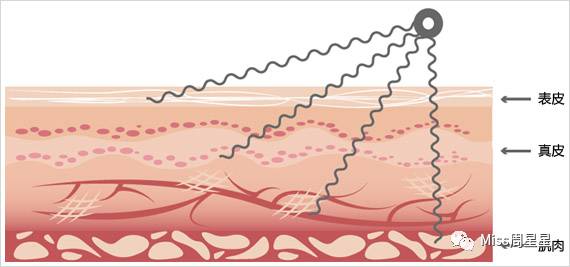refa美容仪真的有用吗,refa美容仪是什么原理