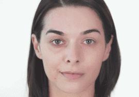 长了“*褐斑黄**”被老公嫌弃该怎么救？祛斑“神药”能随便吃吗？