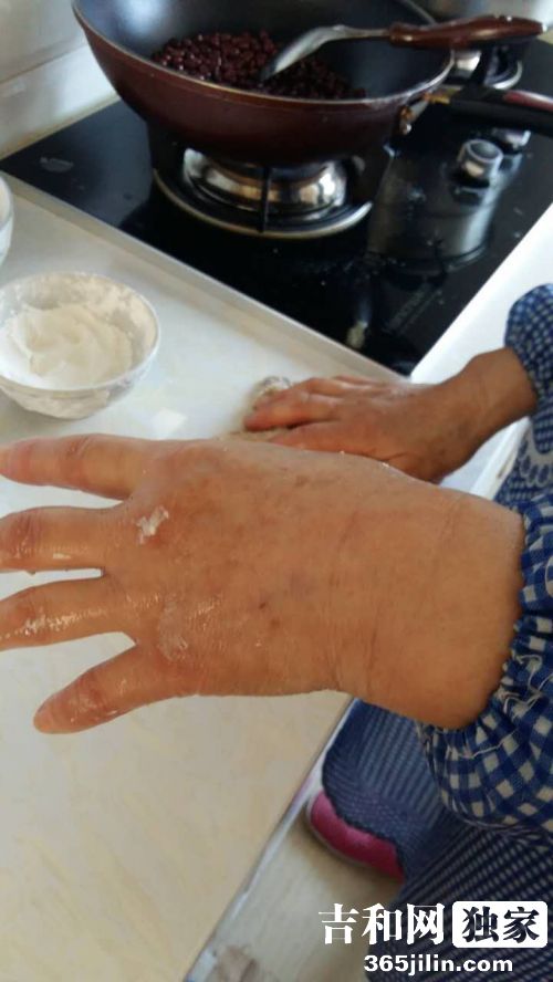 除夕夜九台4岁的小然然被诊断为白血病躺在病床上