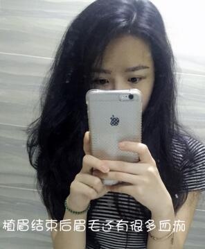 眉毛稀少是否也能种植,眉毛短可以种植眉毛吗