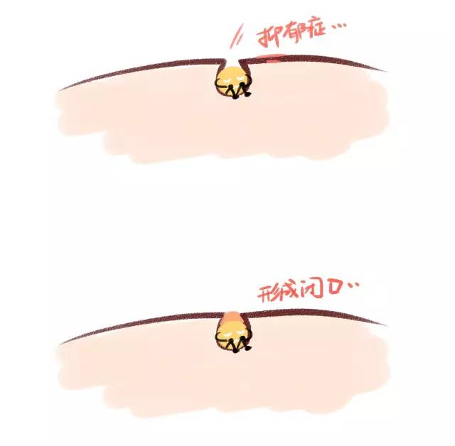 涓嶈姳閽辫繕鏈夋晥鐨勫幓榛戝ご鏂规硶get,娓╁拰楂樻晥鍘婚粦澶寸殑鏂规硶