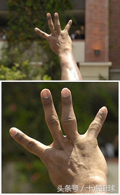 有回报必有付出，看看NBA超巨的手指脚趾，难以想象的痛苦程度