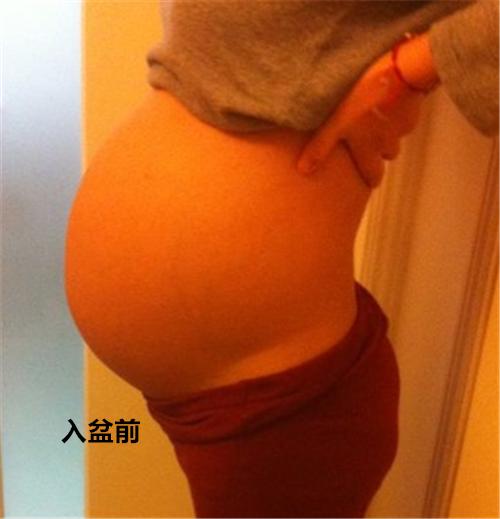 胎儿入盆会有什么表现想顺产的妈妈看这里详细入盆图解