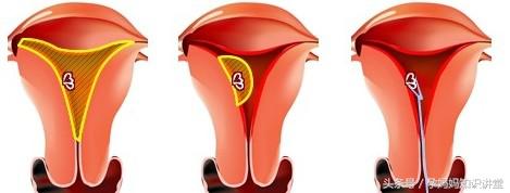 孕期胎儿最怕的9件事,孕期如何判断胎儿安危