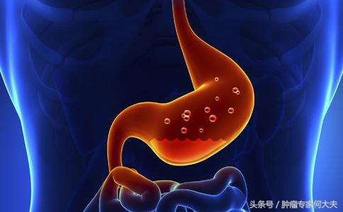 萎缩性胃炎癌前病变,萎缩性胃炎伴肠化生是癌前病变吗