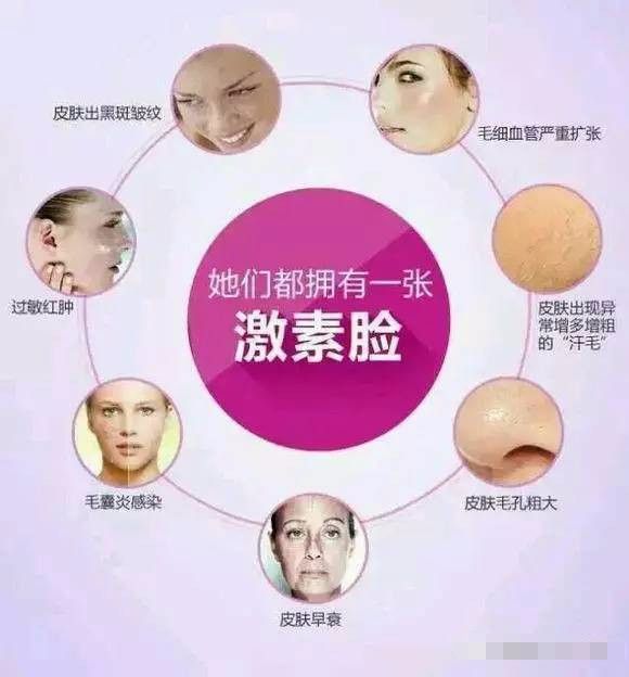 真实的激素脸有多可怕,激素脸凉可怕吗