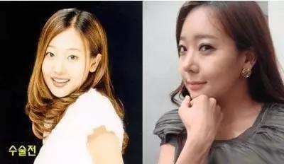 鼻子垫的太往上了,鼻子垫得不高是不是不容易歪