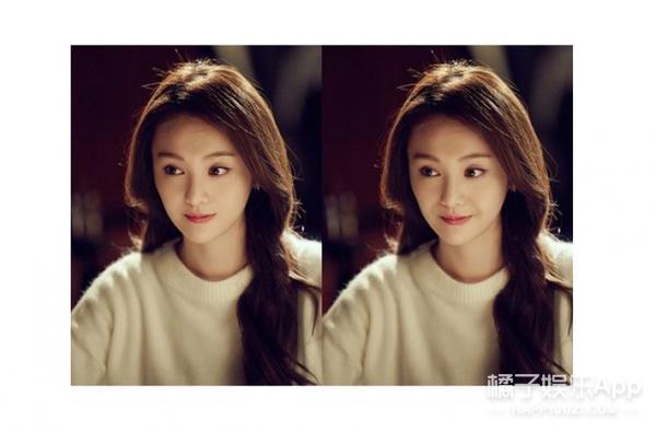 笑容引起的法令纹怎么解决,明星淡化法令纹最简单方法