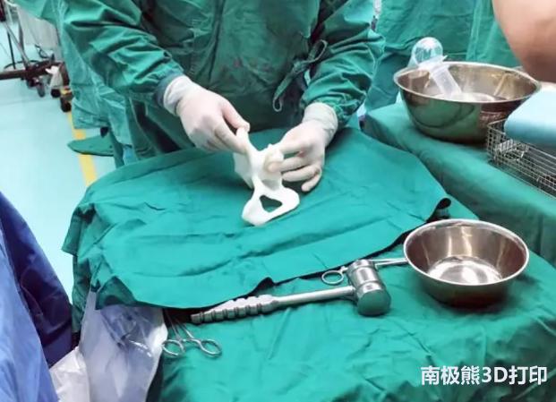 华曙高科3D打印辅助全髋关节置换术成功率达100%