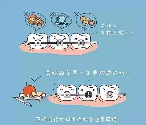 儿童口呼吸牙齿矫正最佳年龄,儿童牙齿矫正最佳年龄及注意事项