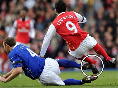 这是在踢球还是踢腿？球员要学会保护自己！