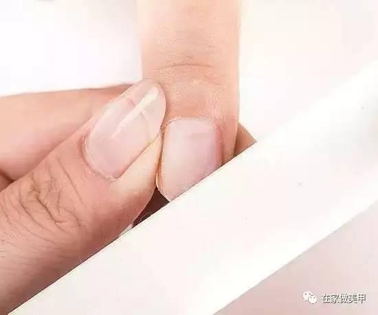 玛塔龟指甲断了,玛蒂折断手指