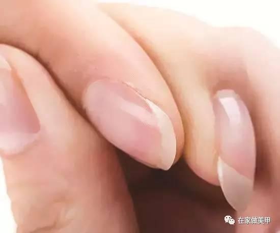 玛蒂被折断手指,玛蒂折断手指