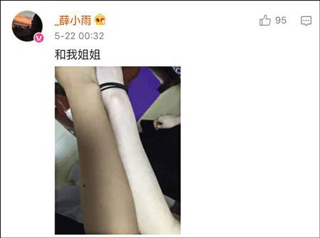 皮肤黑怎么调理能变白,皮肤黑是一种什么样的体验