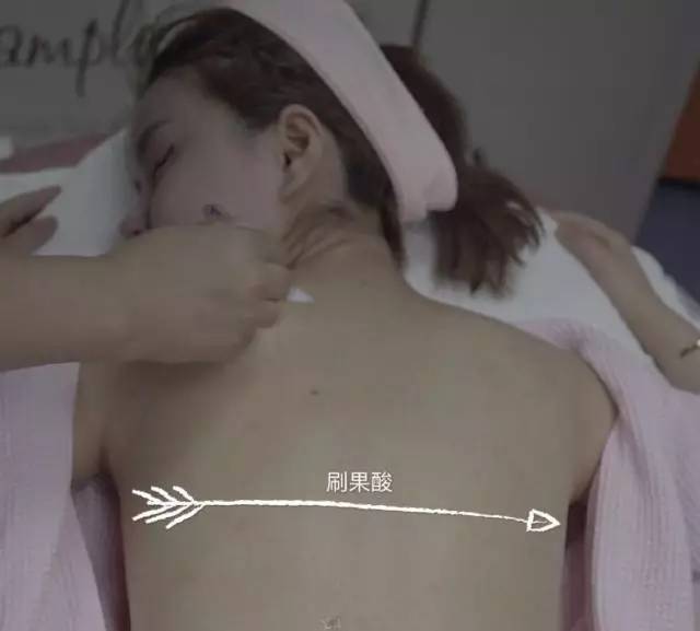 这可能是夏天穿吊带最大的烦恼……这可能是背部痘痘最全攻略