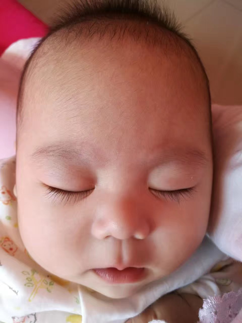 宝宝湿疹反反复复要怎样改善呢,宝宝湿疹反复发作难治愈