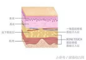 给猪打针起包怎么处理,怎样克服给猪打针的恐惧