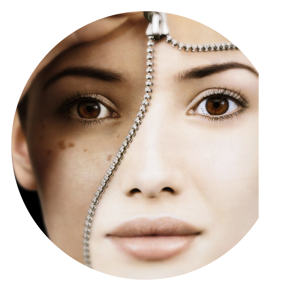 刚出现的晒斑能自然消退吗,你知道祛除晒斑4大误区吗