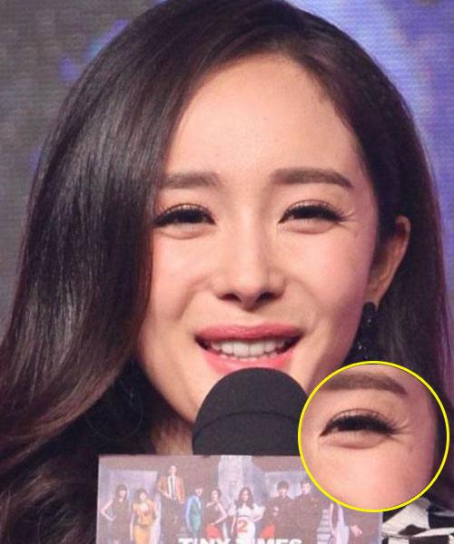 因为爱笑眼角皱纹比较多怎么办,爱笑的女孩有笑纹怎么办