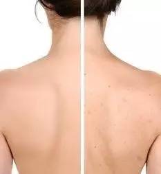 比吃饭更紧急，身体去角质今天晚上就得做起来