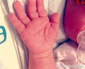 断掌的宝宝智力真的有问题,断掌的孩子聪明吗