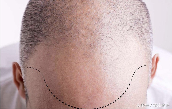 香味和护发并存的护发精油,混合型护发精油