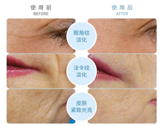 兔妈分享丨价格好爆！以色列Tripollarstop童颜机Luna洁面仪电动硅胶牙刷，吃土都值得入！