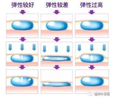 致美玻尿酸这个品牌怎么样,各种品牌玻尿酸价格和质量
