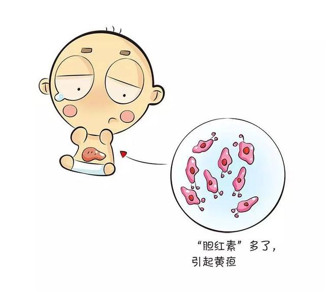 新生儿黄疸怎么有效治疗,新生儿黄疸怎么办教你一招解决