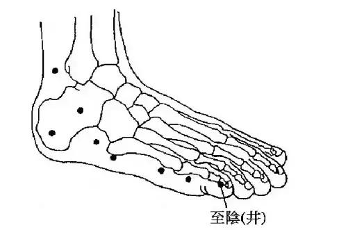怎样自己判断臀位已转正,臀位回正有什么方法