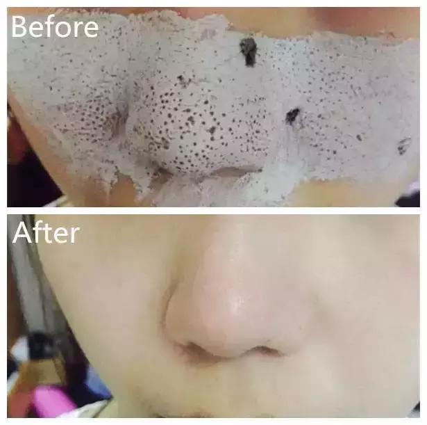 十分钟就能吸出所有脏东西的面膜,清洁面膜吸出垃圾图