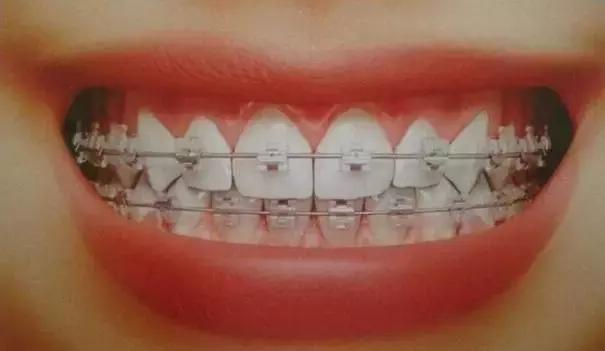 小孩牙齿缝隙大是什么原因,40岁女性牙齿缝隙变大是什么原因