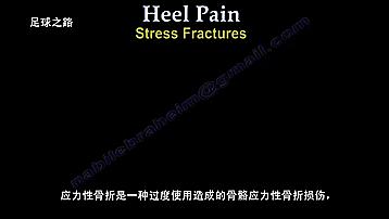 足跟痛的症状及表现,足跟痛最常见病因