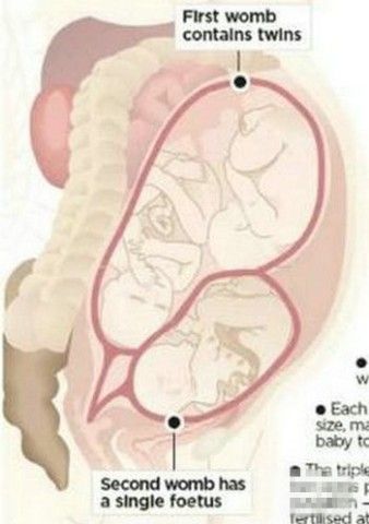 世界上比较诡异的人,世界上最诡异的十种人