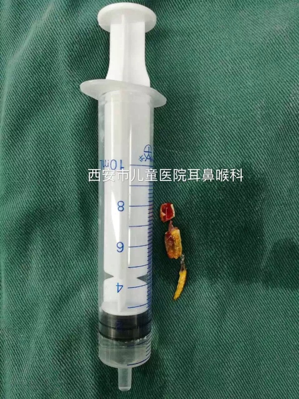 5岁孩子吃螃蟹,小孩吃螃蟹片段