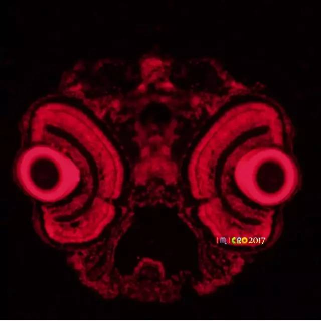 显微镜奇妙世界,显微镜下的奇妙世界视频