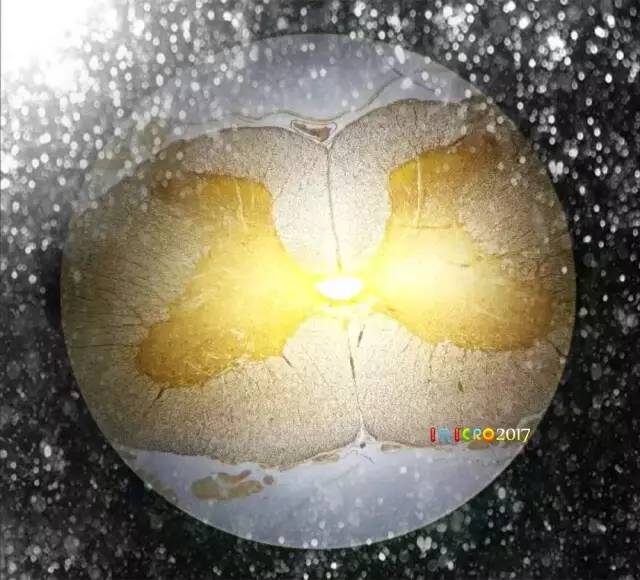 显微镜奇妙世界,显微镜下的奇妙世界视频