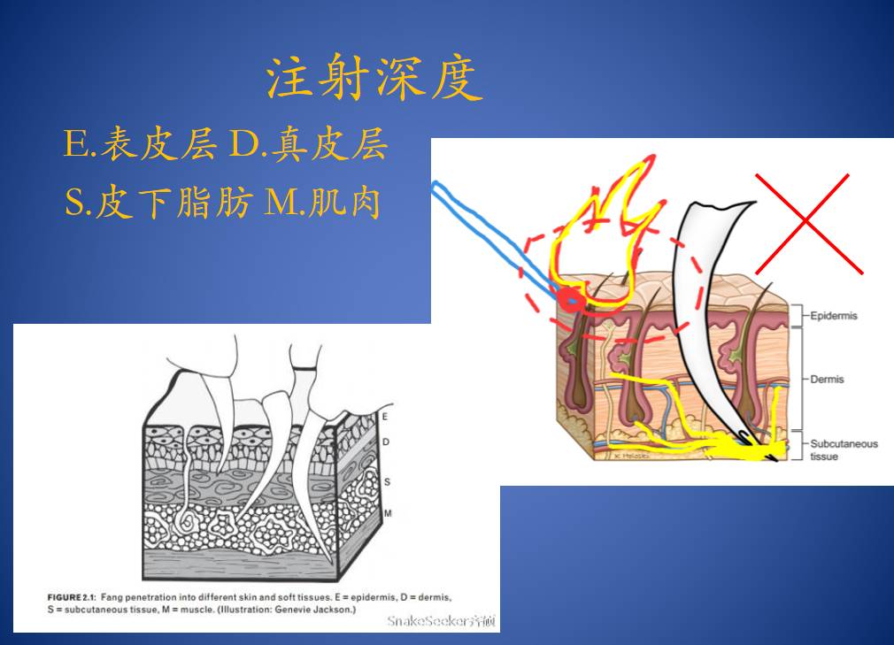 原来，这些救治毒蛇咬伤的方法都不靠谱